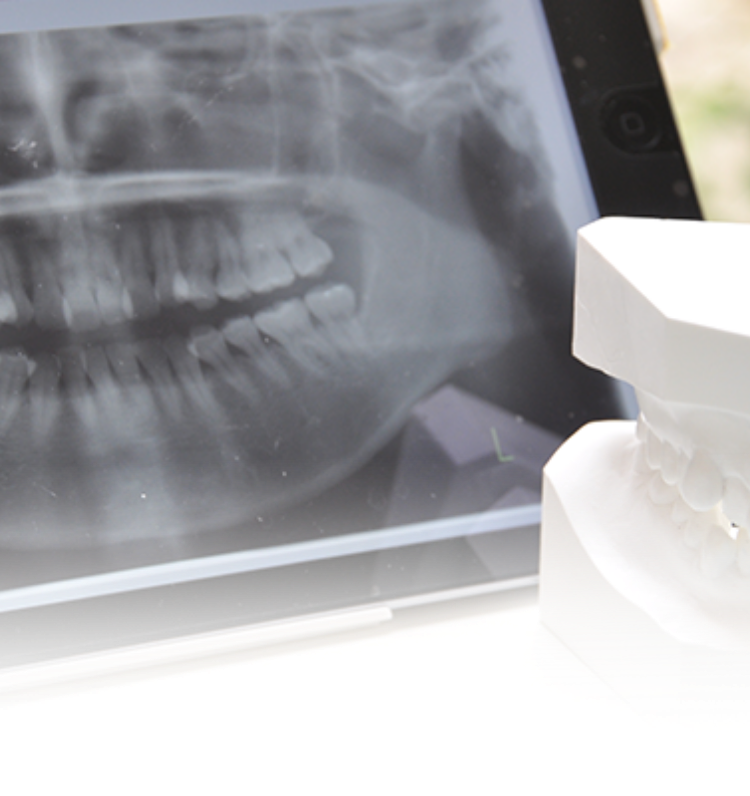 こばやし歯科医院が行う全顎治療のイメージ