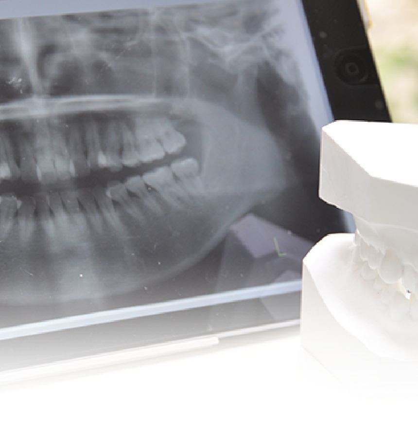 こばやし歯科医院が行う全顎治療のイメージ
